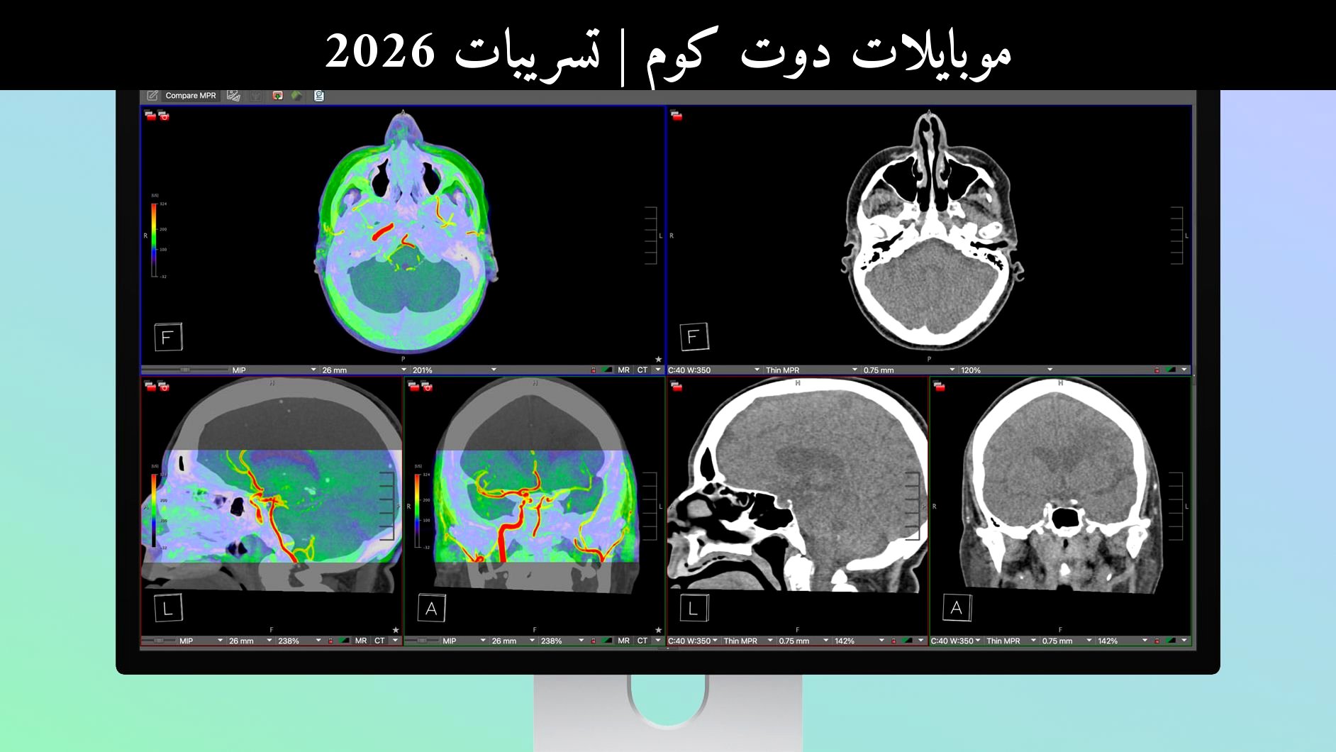 تسريبات 2026: شاشة Apple Studio Display XDR تحصل على اعتماد FDA للتصوير الإشعاعي