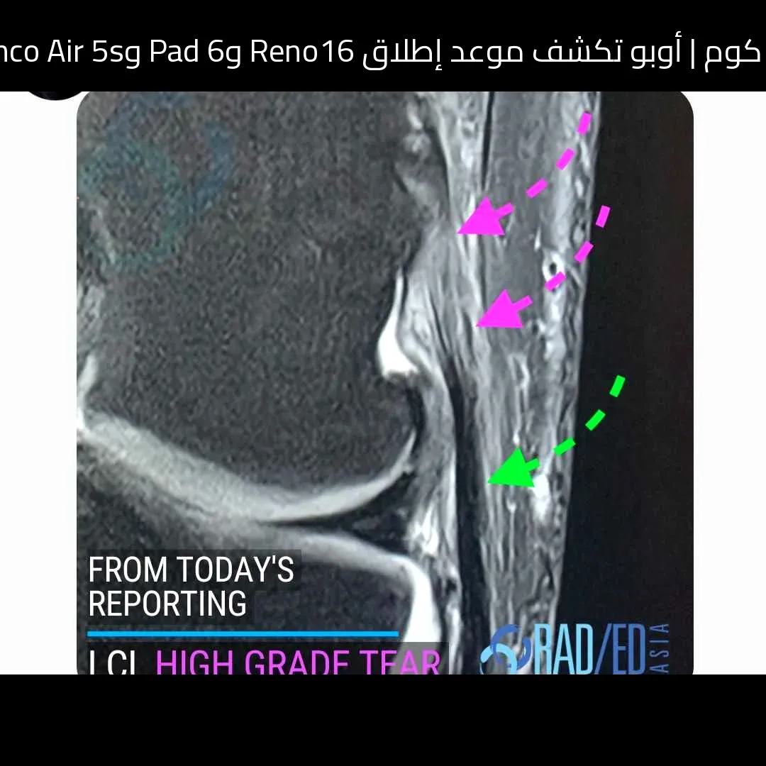 أوبو تكشف موعد إطلاق Reno16 وPad 6 وEnco Air 5s في 25 مايو